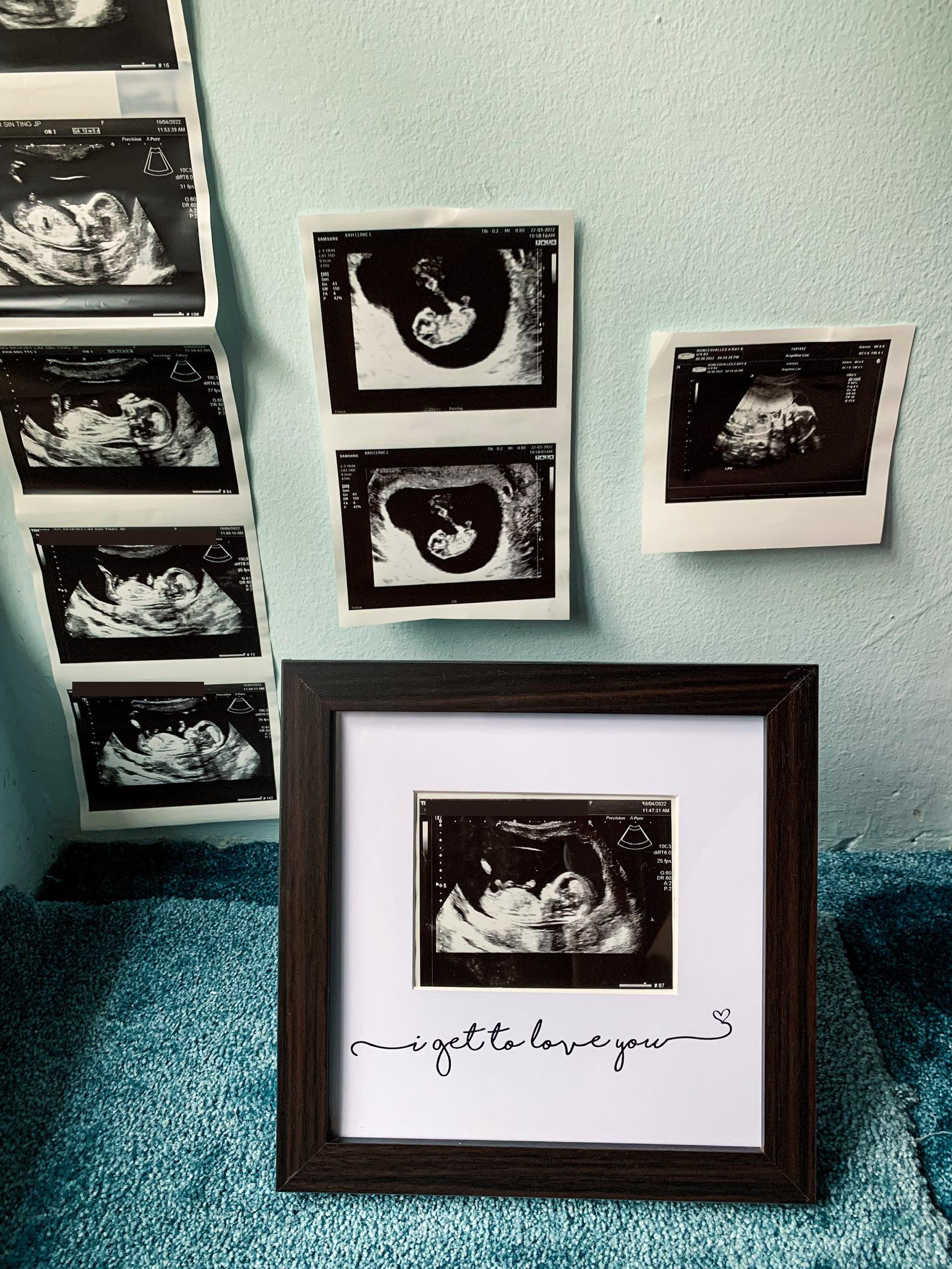 SavvyMama | Baby Sonogram Picture Frame